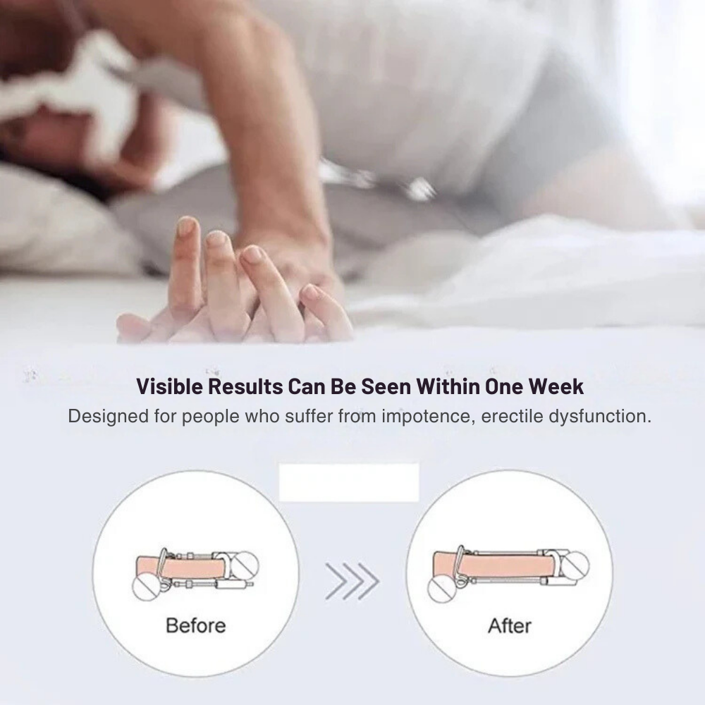 MAXX IMPROVE Penis Extender With Clamp Stretcher - Maxx Improve